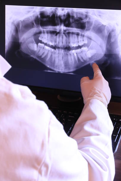 Best Chipped Tooth Repair Near Me  in Ellsworth, WI